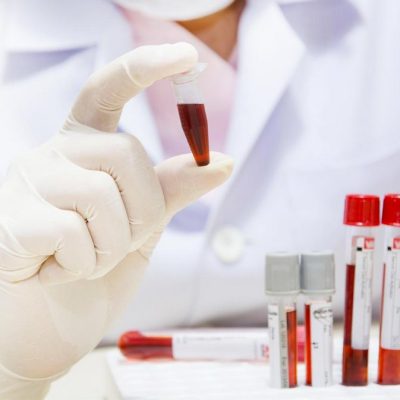Understanding the Different Types of Hormone Tests